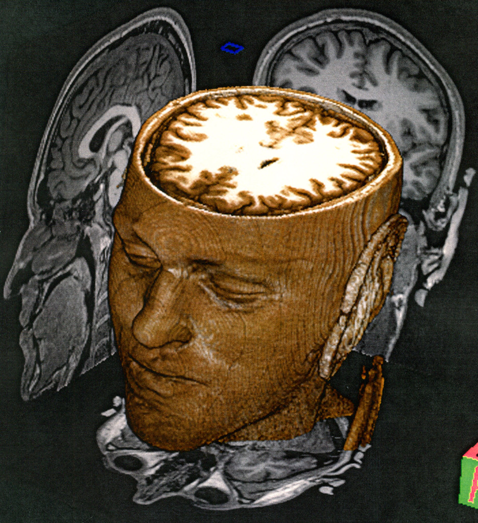 "This is my brain" by killermonkeys is licensed under CC BY-NC 2.0.